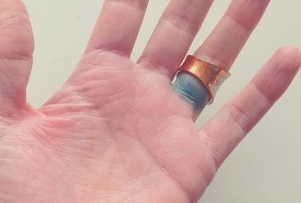 Por que los anillos dejan los dedos verdes después de usarlos